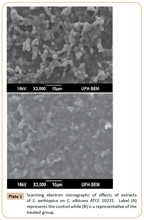 pharmaceutical-microbiology-Scanning-electron