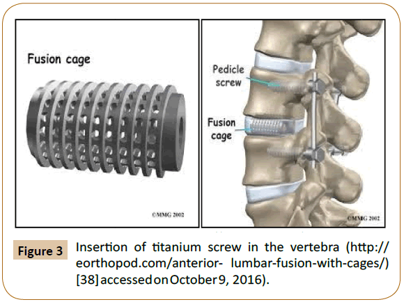 pharmaceutical-microbiology-screw